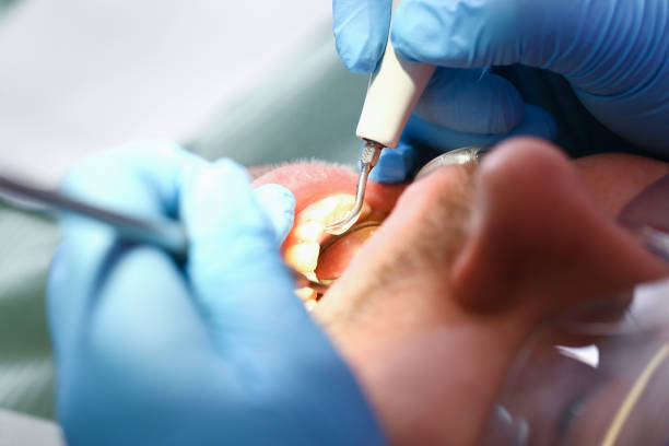 Best Emergency Dental Care for Broken or Chipped Teeth in Bogota, NJ